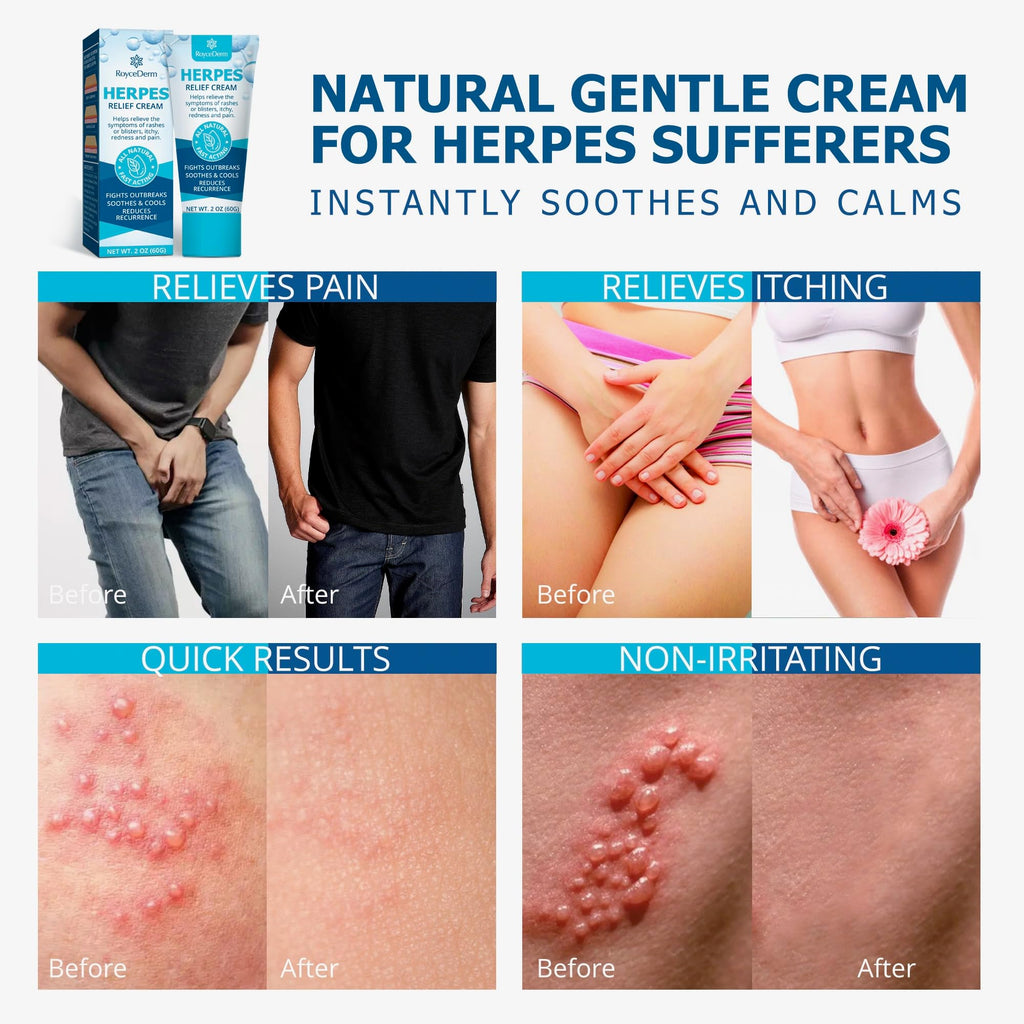 Herpes Cream X324670