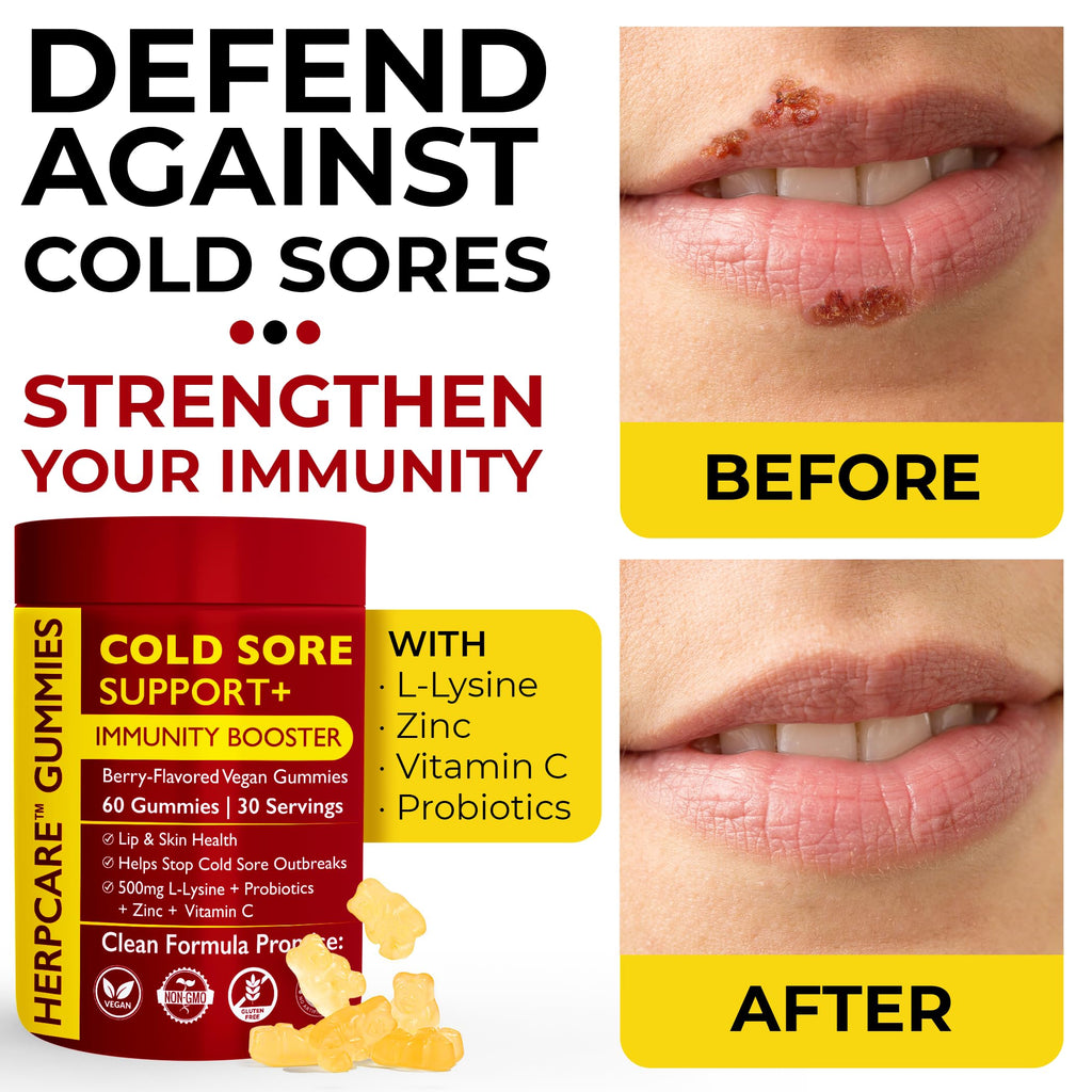 Cold Sore Treatment with L-Lysine, Zinc & Vitamin C E392