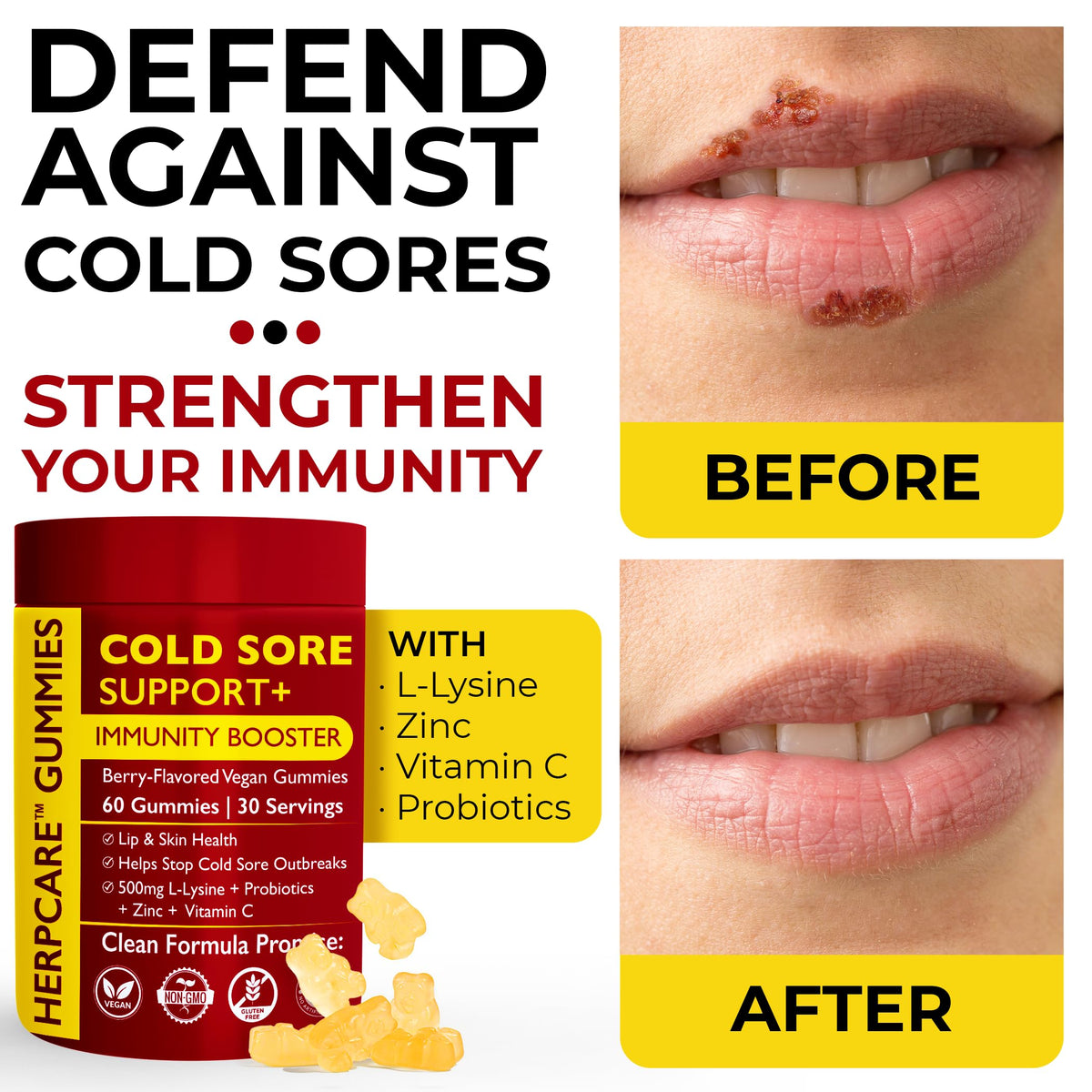 Cold Sore Treatment with L-Lysine, Zinc & Vitamin C E392