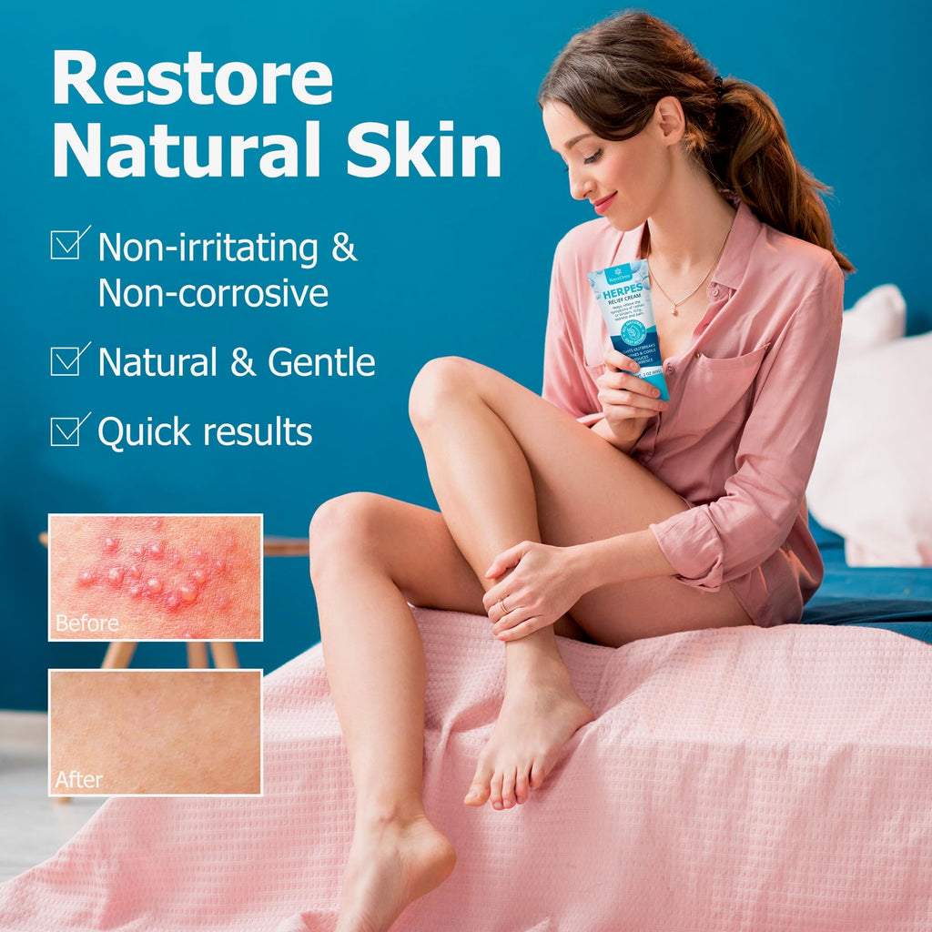 Herpes Cream X324670